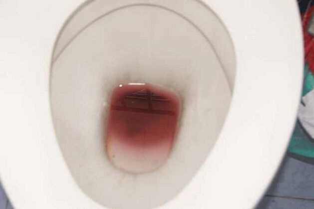 men are noticed when excited